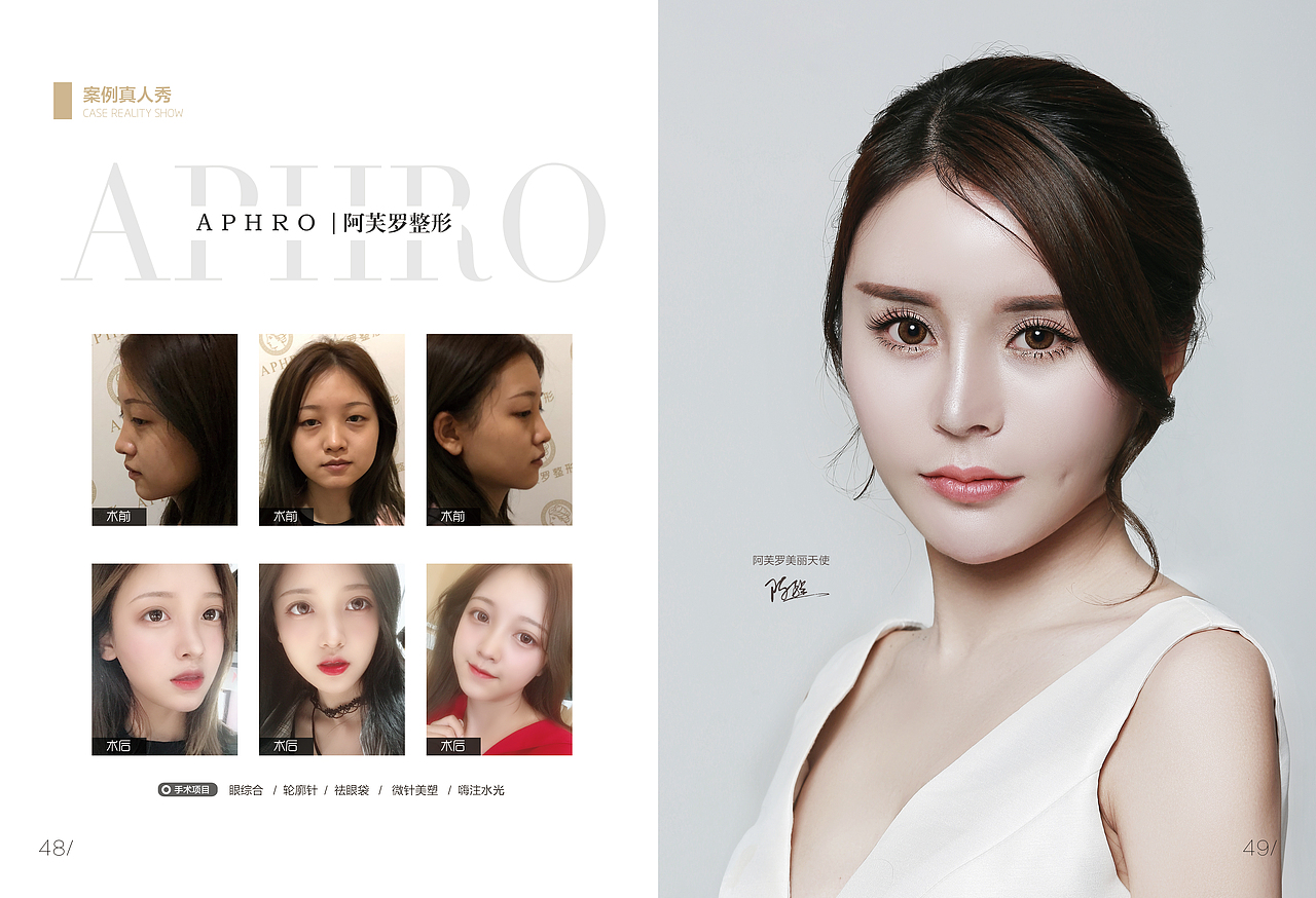 整形医院美容画册折页三折页画册杂志海报设计品牌画册（图ZMTI4MzA1MzU2） - 书籍/画册 - 站酷设计师是杯酒是咖啡原创素材 - 站酷ZCOOL