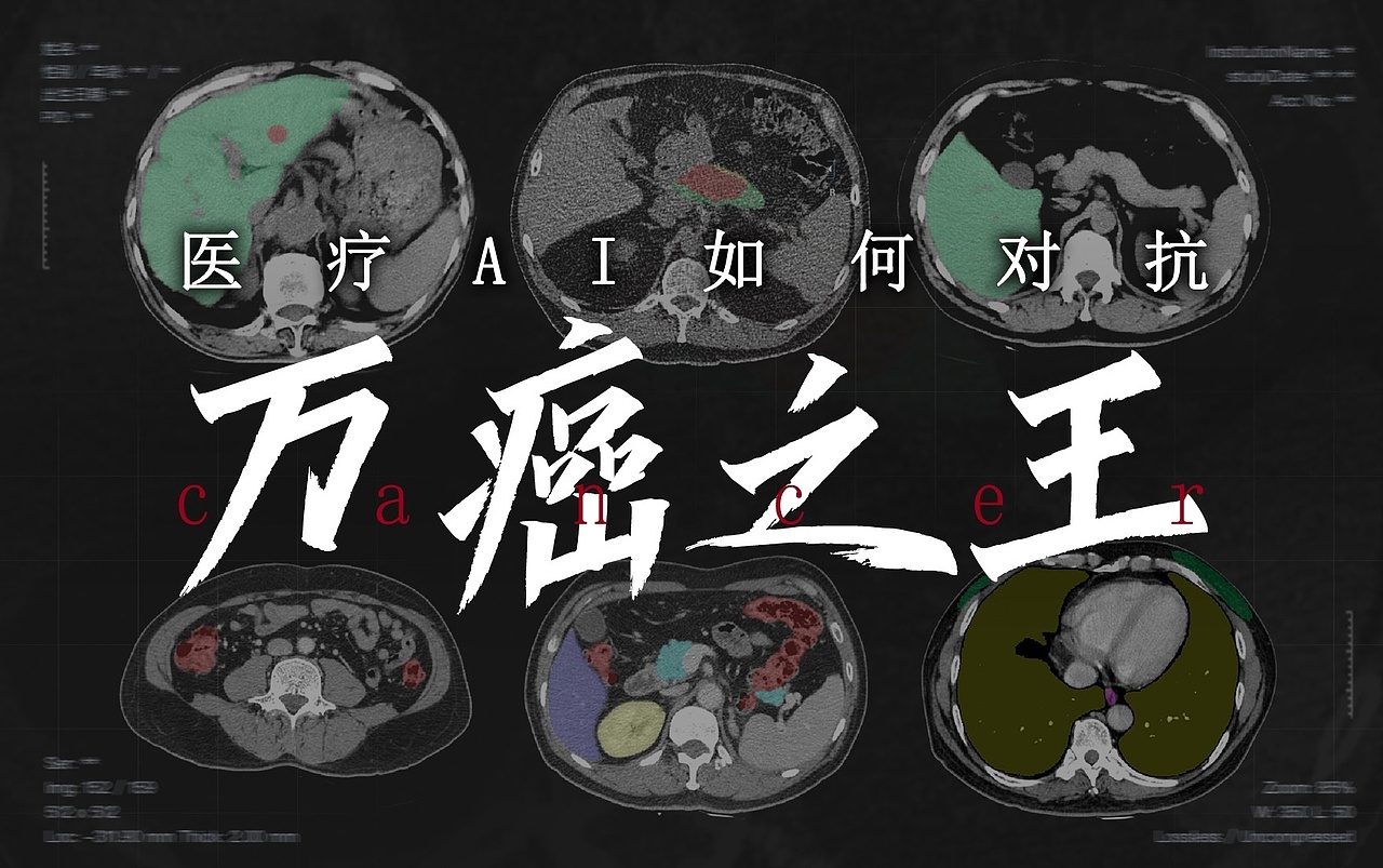 【客户案例】阿里达摩院《医疗AI如何对抗万癌之王》