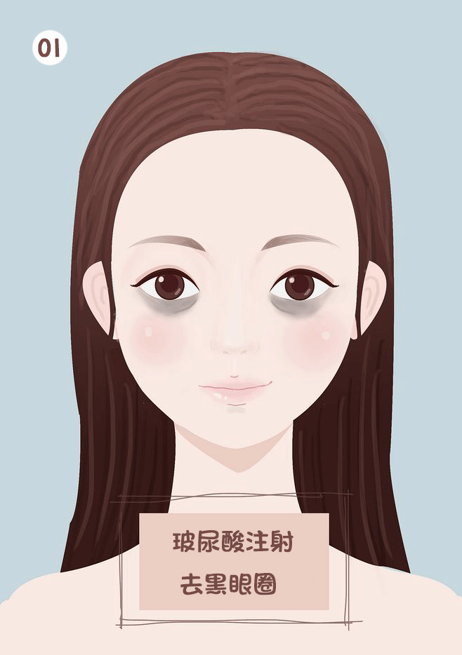 玻尿酸，玻尿酸填充，玻尿酸丰脸部（图ZMTk5NzA4MzY0） - 艺术插画 - 站酷设计师没事画画哦原创素材 - 站酷ZCOOL