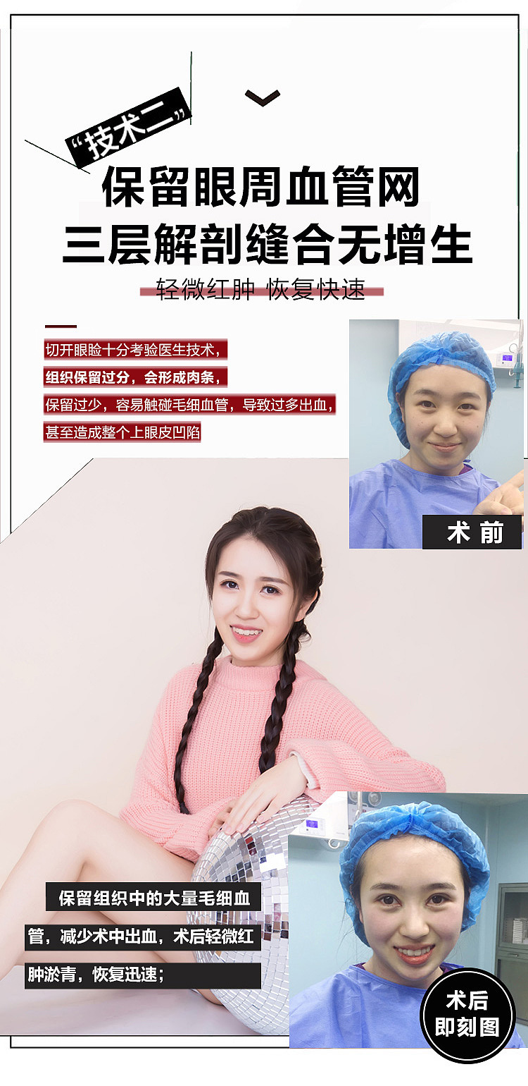 新氧新版详情页（图ZMTU4MDIwMzQ0） - 海报 - 站酷设计师叫我小可乐吧原创素材 - 站酷ZCOOL