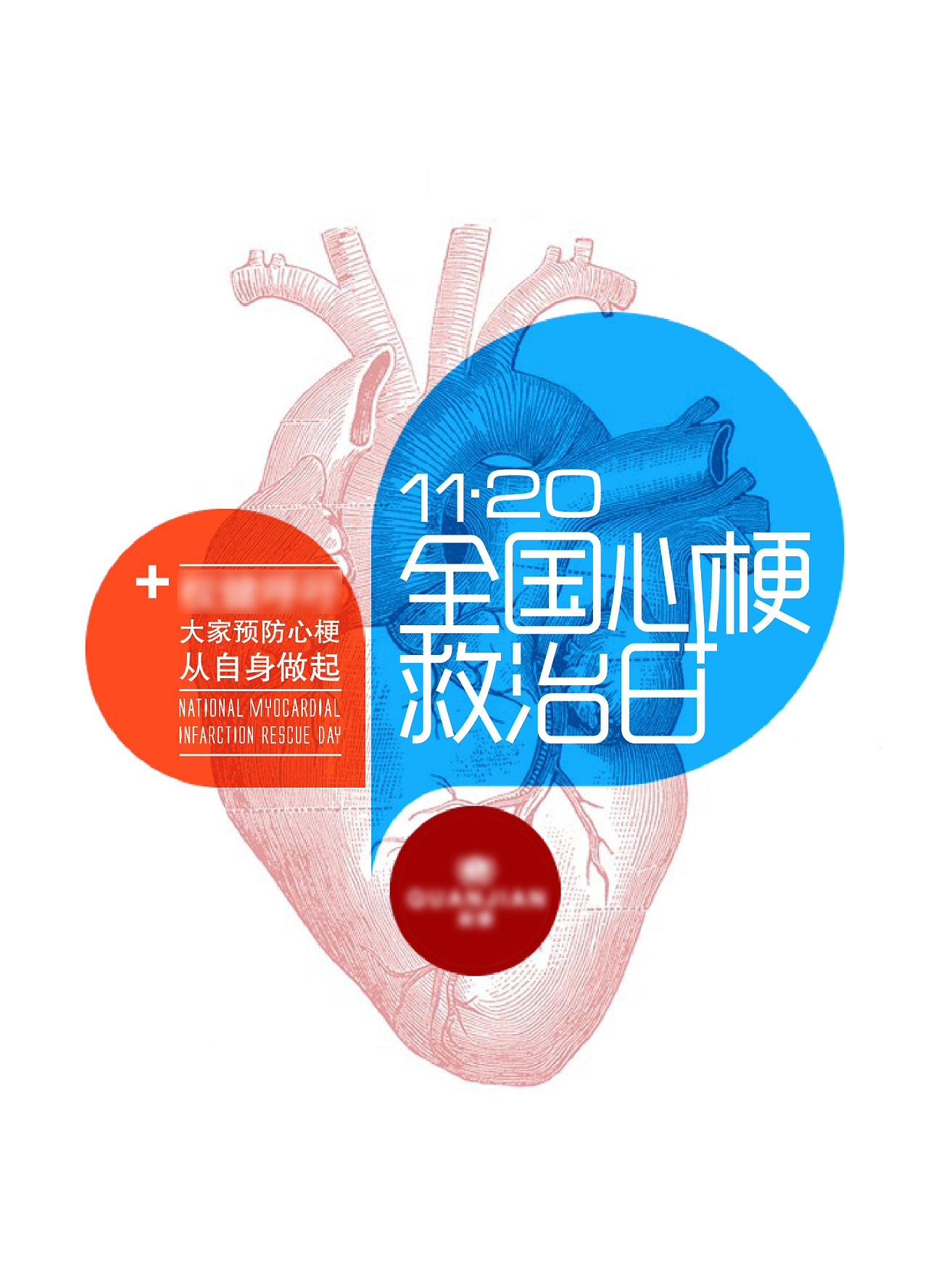11.20心梗救治日