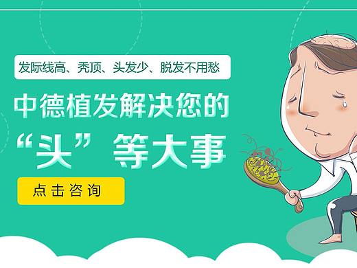 植发