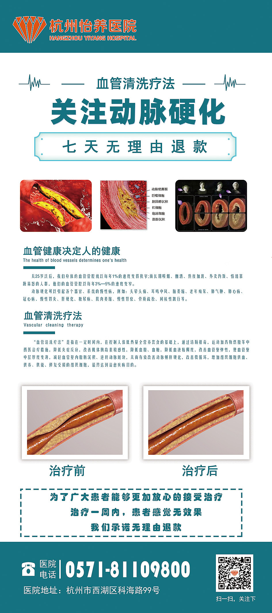 医院高血压动脉硬化宣传展架