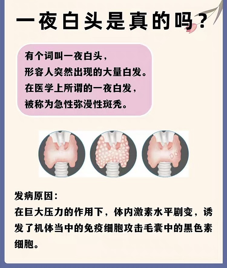 人为什么会有白头发？（图ZMzAyNTMyNjcy） - 其他 - 站酷设计师Z809218278原创素材 - 站酷ZCOOL