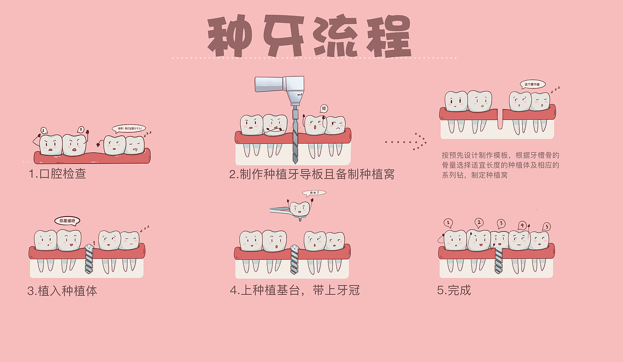 种牙流程