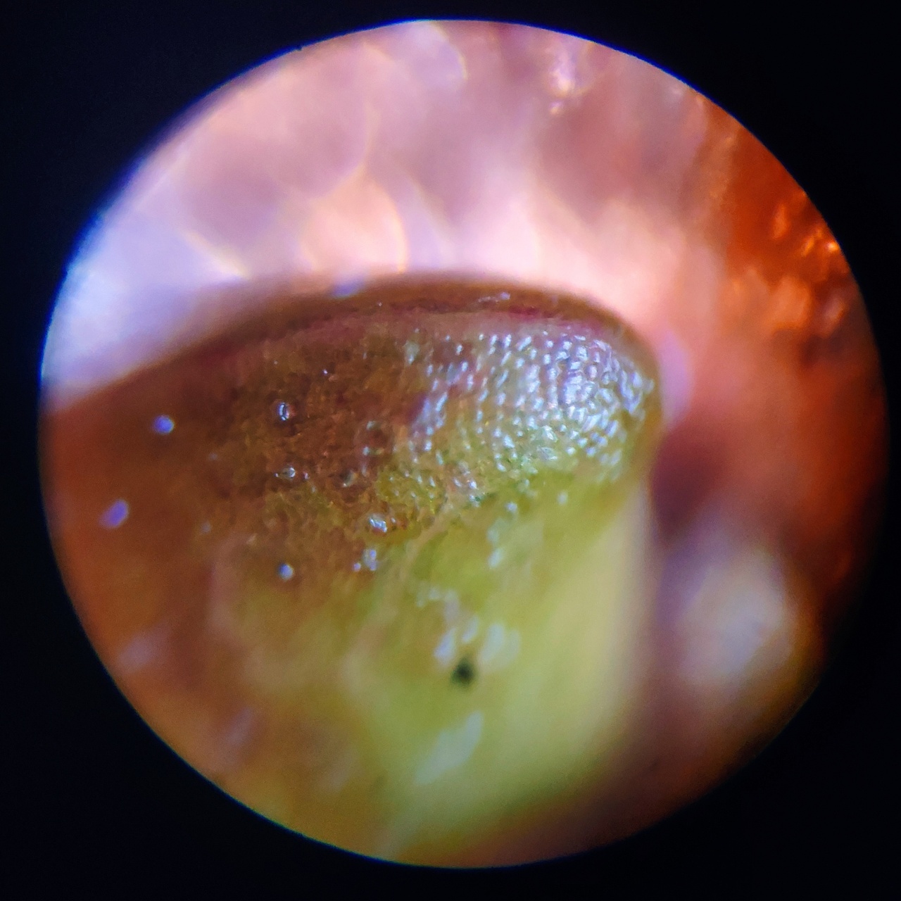 显微镜草莓摄影