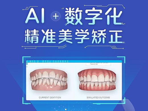 正畸
