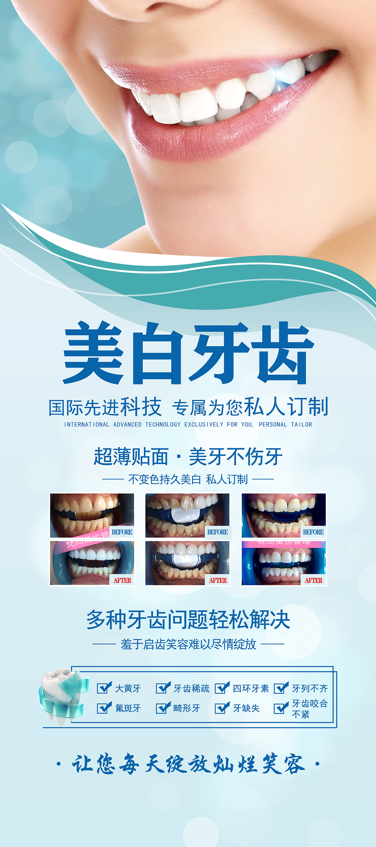 口腔种植牙，海报|平面|品牌|YJING99328 - 原创作品 - 站酷 (ZCOOL)
