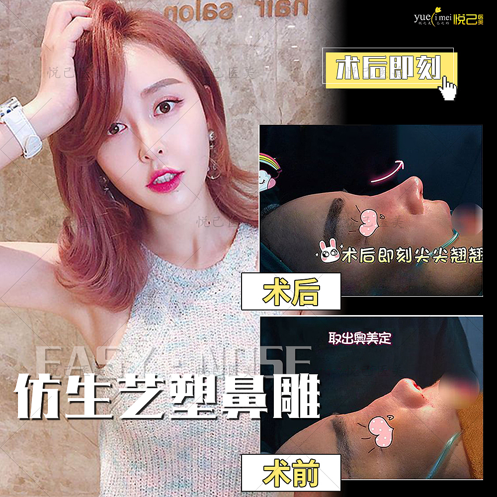 医美案例对比图