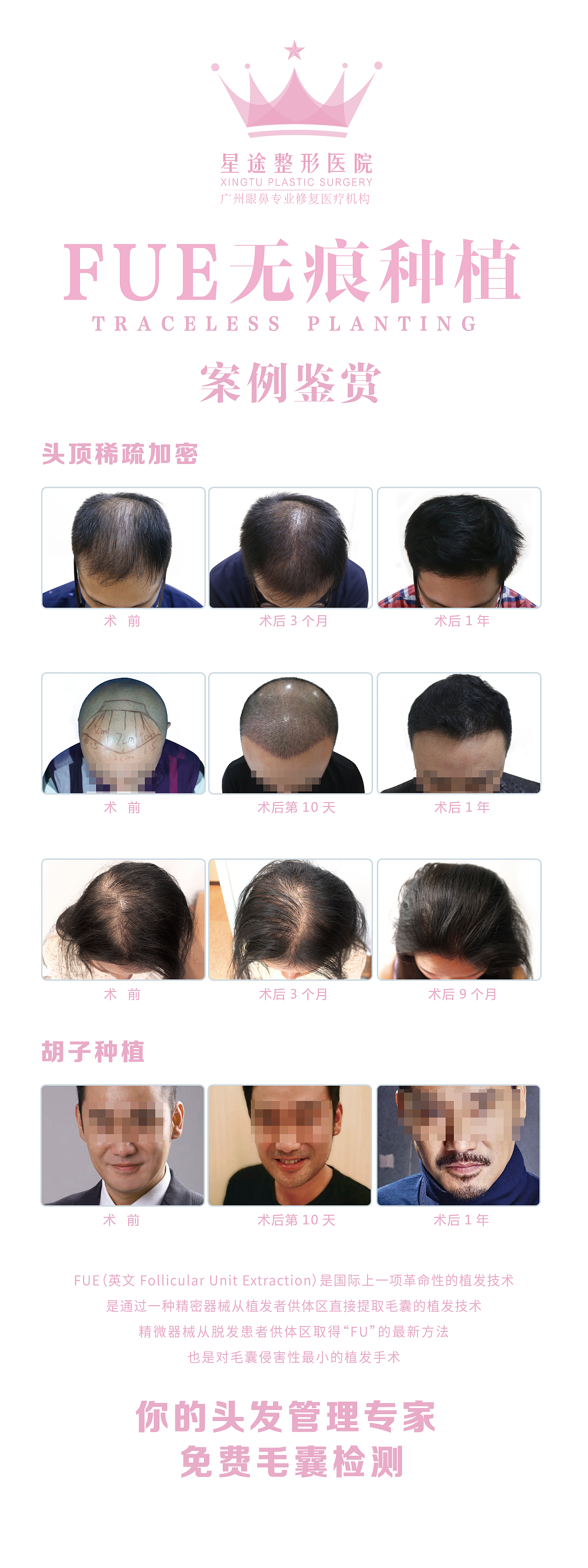 医美展架（图ZMjI3ODQ5Mzky） - 宣传物料 - 站酷设计师OneAlan原创素材 - 站酷ZCOOL