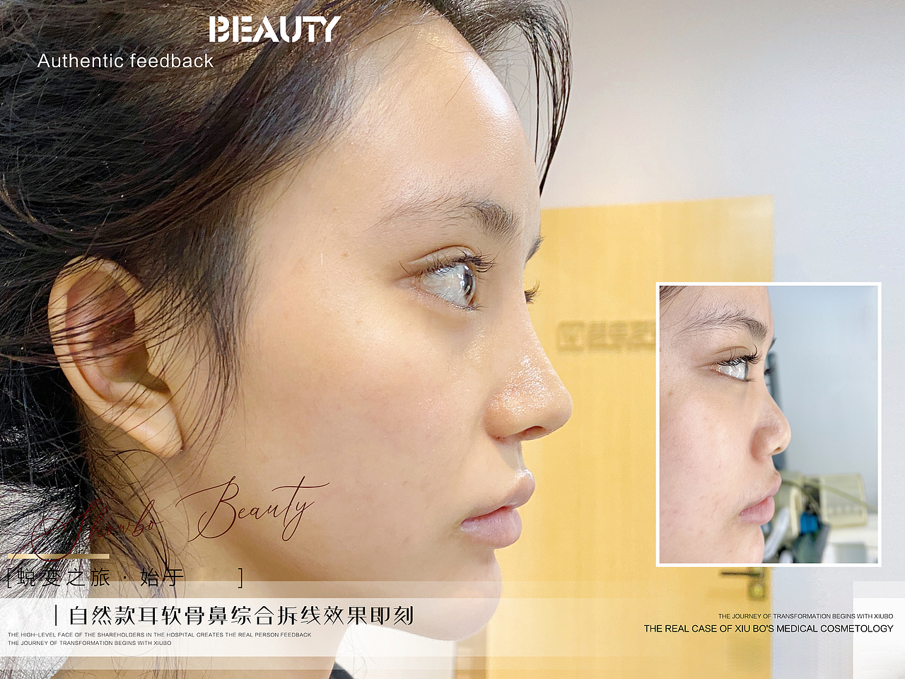 醫(yī)美整形案例分享（圖ZMjk5OTUzNDg4） - 海報 - 站酷設計師MMMMMM黃原創(chuàng)素材 - 站酷ZCOOL