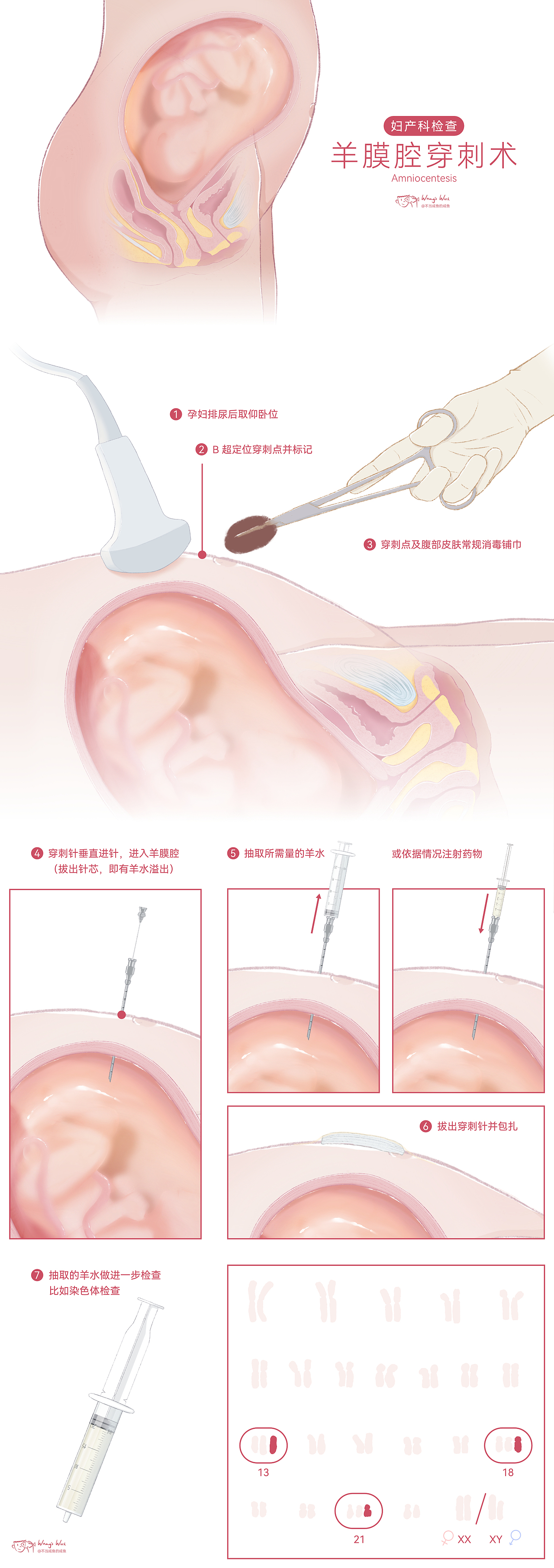 2023医学可视化作品合集（图ZMzU5MjA1ODIw） - 创作习作 - 站酷设计师不当咸鱼的咸鱼原创素材 - 站酷ZCOOL