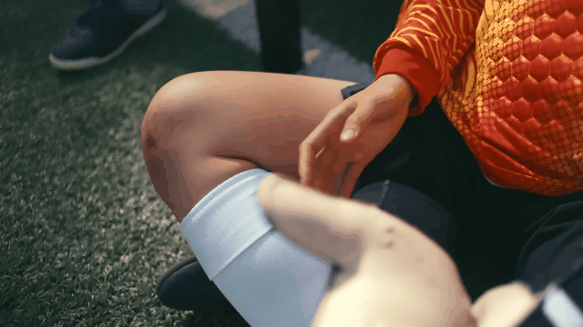 女足运动员真实带紫色淤青参与拍摄