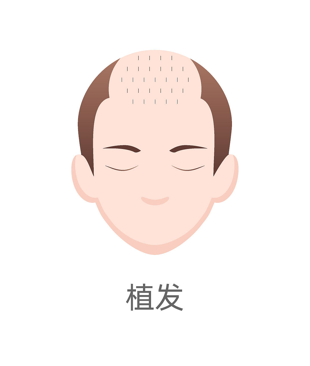 种植毛发（图ZMzA4MjQ2NTQ4） - 商业插画 - 站酷设计师蜀文途话原创素材 - 站酷ZCOOL