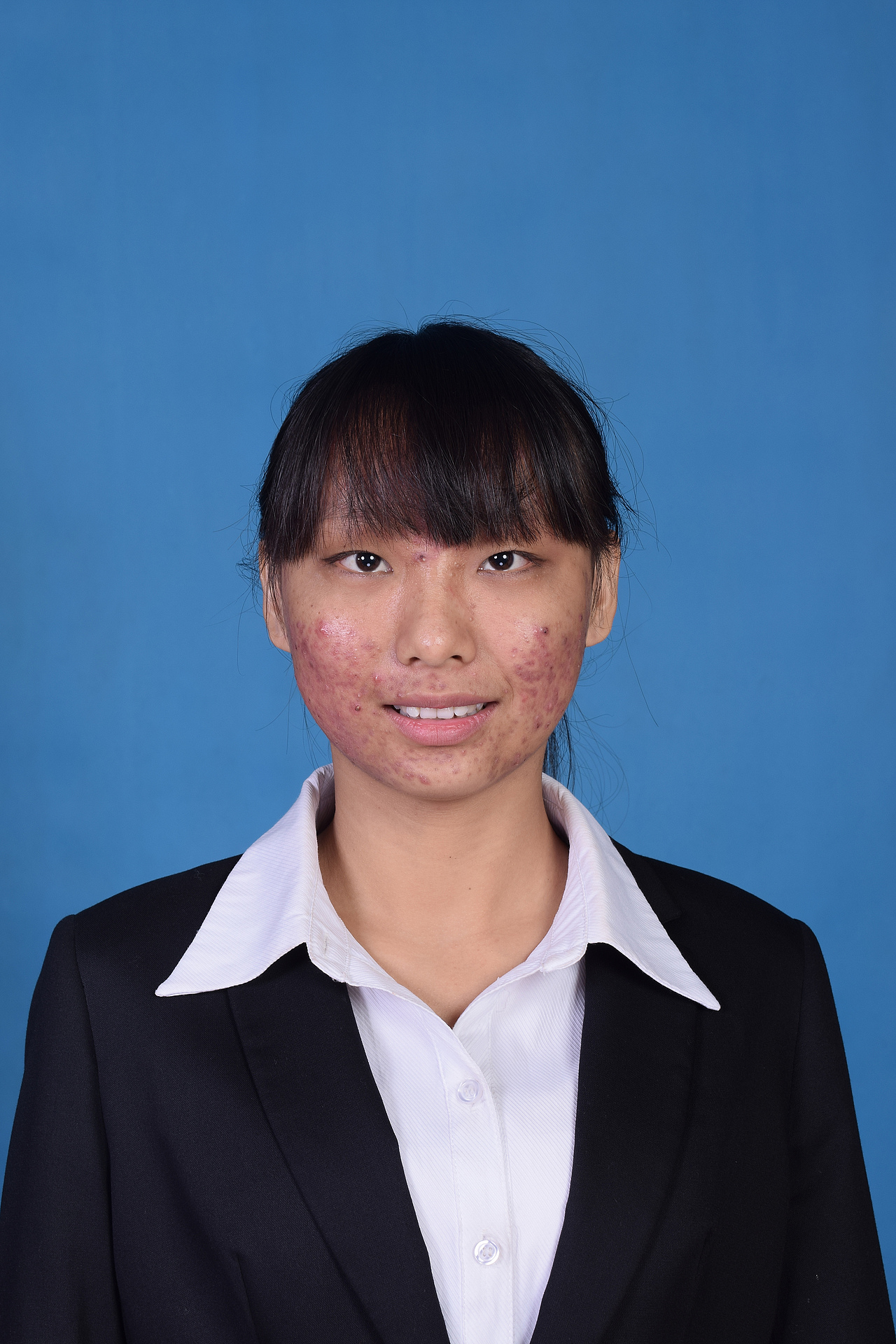 此学妹满脸的痘痘