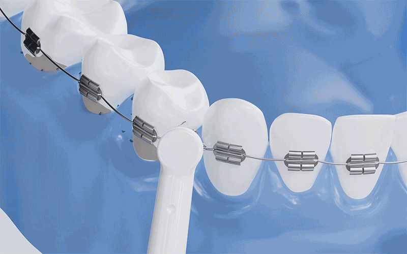 产品动画-电动牙刷（图ZMzQzODI2MDc2） - 其他三维 - 站酷设计师Tongk原创素材 - 站酷ZCOOL