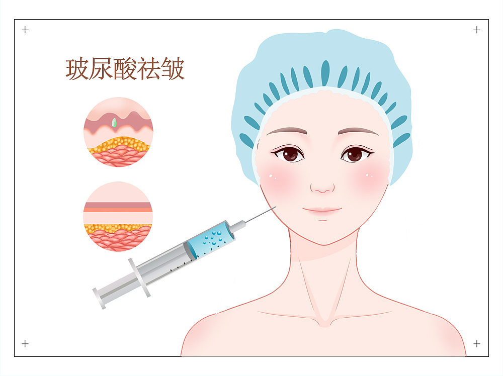 配图 海报（图ZMzY0NDQ4MjUy） - 海报 - 站酷设计师你妖姐原创素材 - 站酷ZCOOL