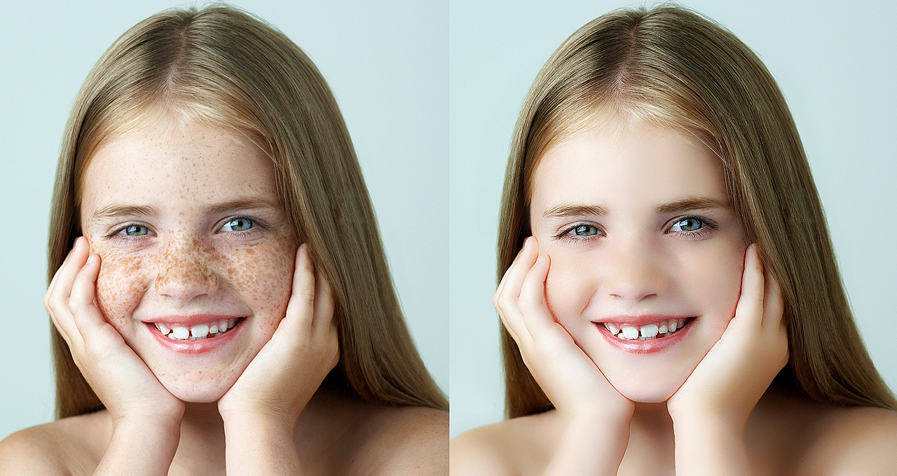 人物精修 如何快速祛斑 前后对比（图ZMzQ1NzEyNzA0） - 修图/后期 - 站酷设计师草莓果粒原创素材 - 站酷ZCOOL