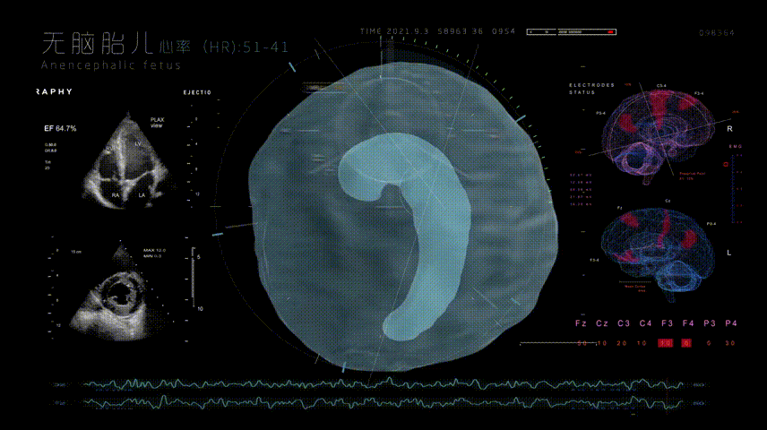 #2022青春答卷#交互装置作品《胎耳》