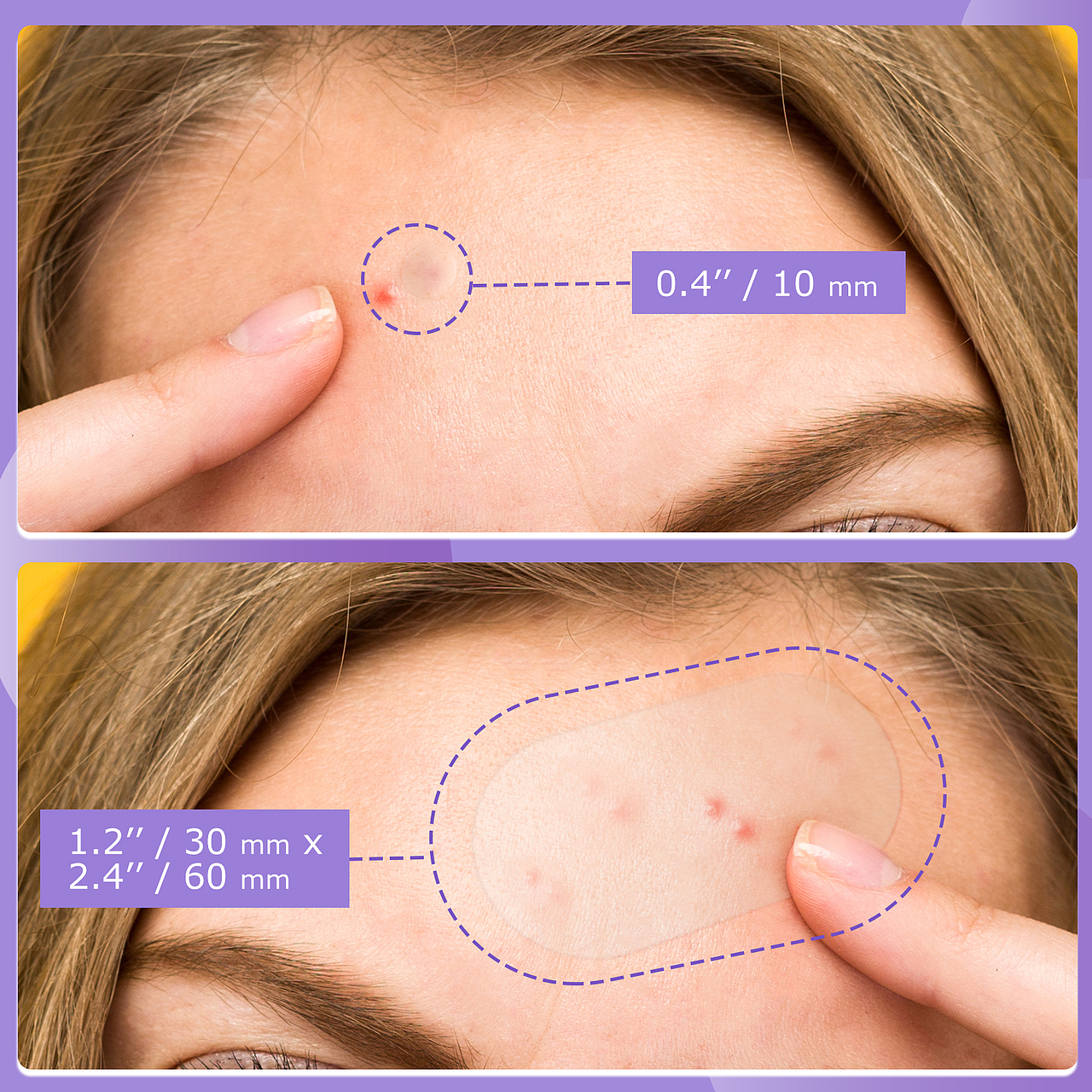 痘痘贴合集（图ZMzA1Mzc2MTIw） - 其他平面 - 站酷设计师偲酷摄影设计原创素材 - 站酷ZCOOL