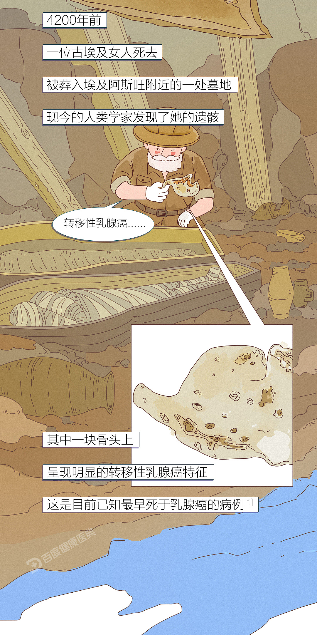 《百度健康医典：乳腺癌》条漫（健康科普）（图ZMzQ5NTU2NDg4） - 短篇/格漫 - 站酷设计师李平LP1919原创素材 - 站酷ZCOOL