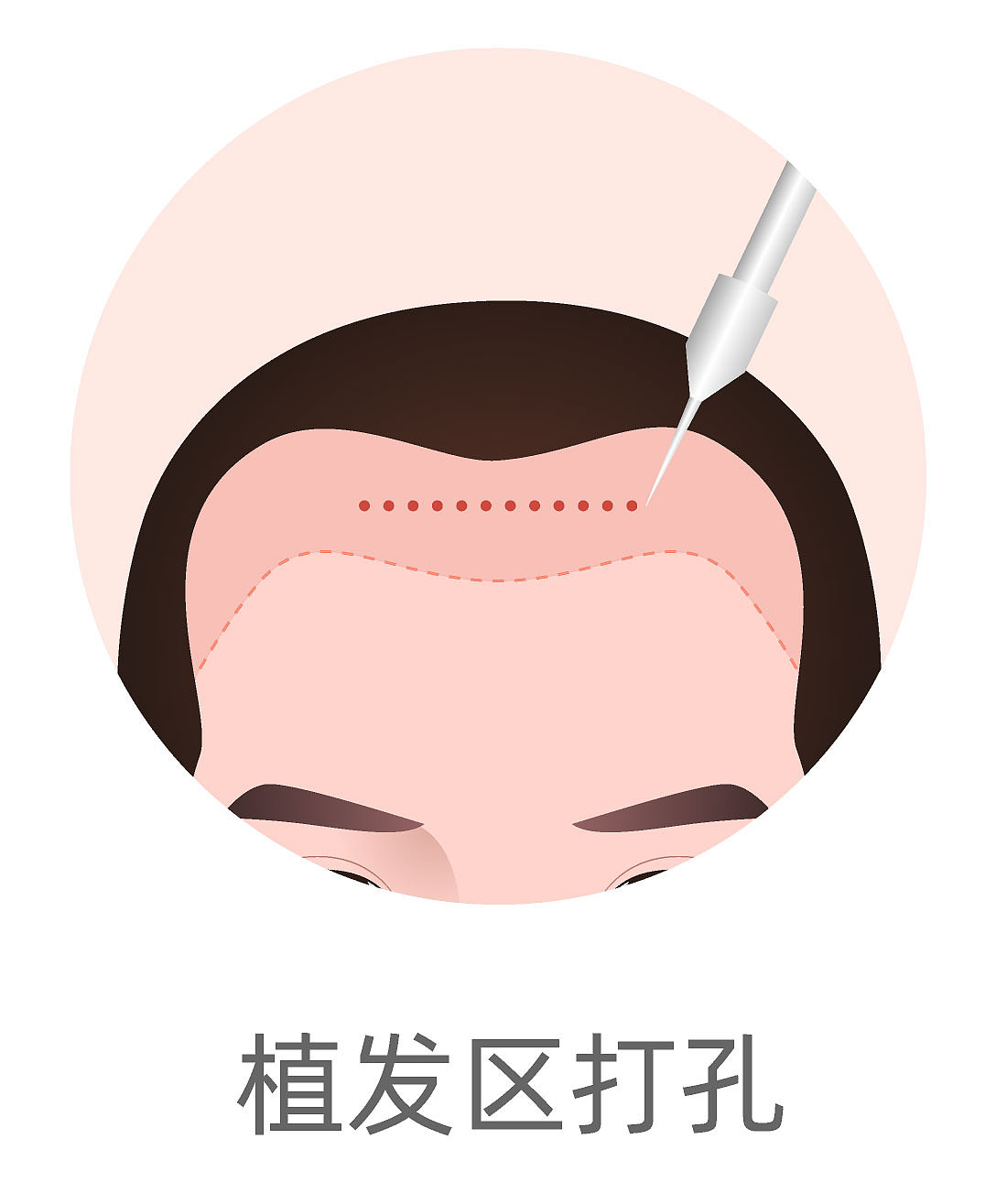 种植毛发（图ZMzA4MjQ2NjAw） - 商业插画 - 站酷设计师蜀文途话原创素材 - 站酷ZCOOL