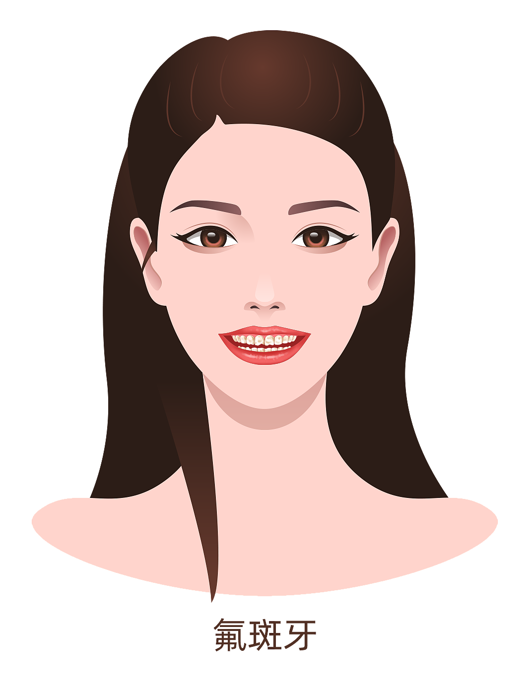 多生牙、氟斑牙、黄牙、四环素牙、牙结石（图ZMzA4MjU0NjIw） - 商业插画 - 站酷设计师蜀文途话原创素材 - 站酷ZCOOL