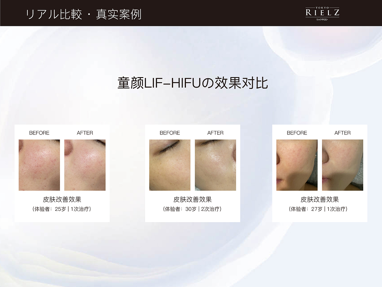 美容院护理项目册子（图ZMzI4OTMzNTU2） - 海报 - 站酷设计师舒群貽原创素材 - 站酷ZCOOL