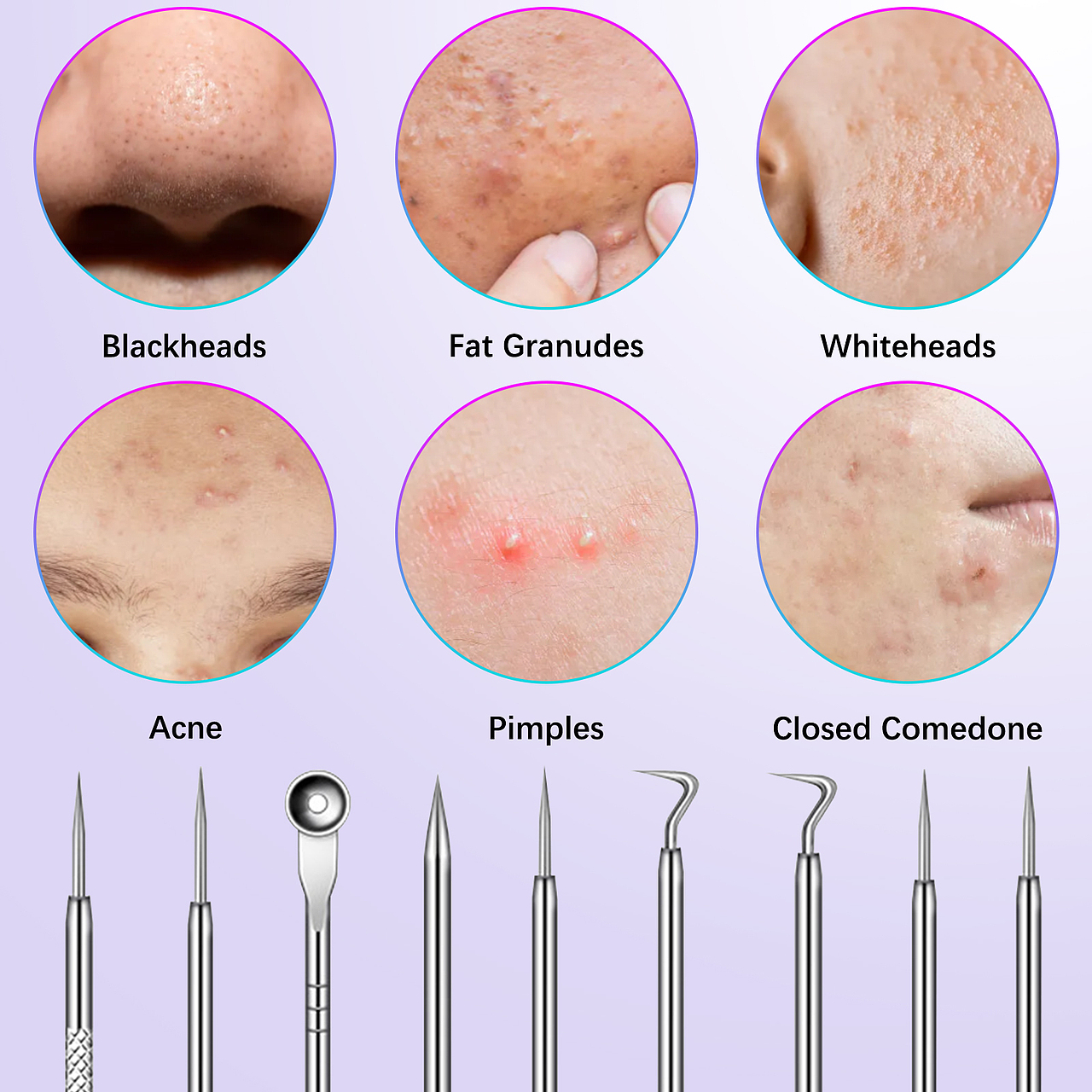 不锈钢粉刺针套装