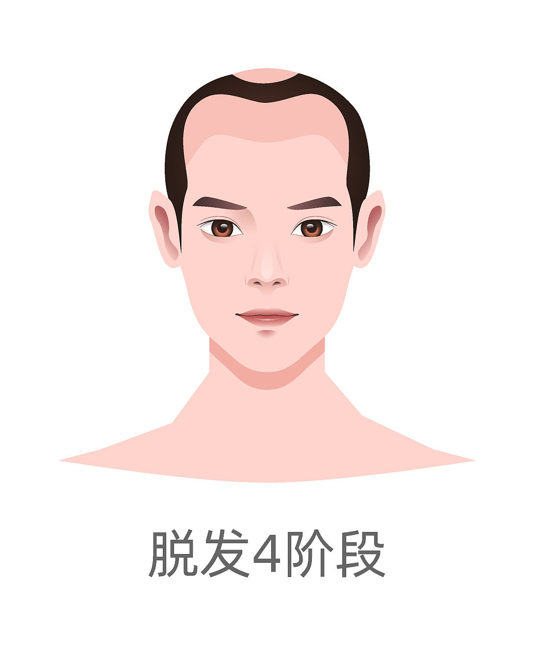 种植毛发（图ZMzA4MjQ2NDY0） - 商业插画 - 站酷设计师蜀文途话原创素材 - 站酷ZCOOL