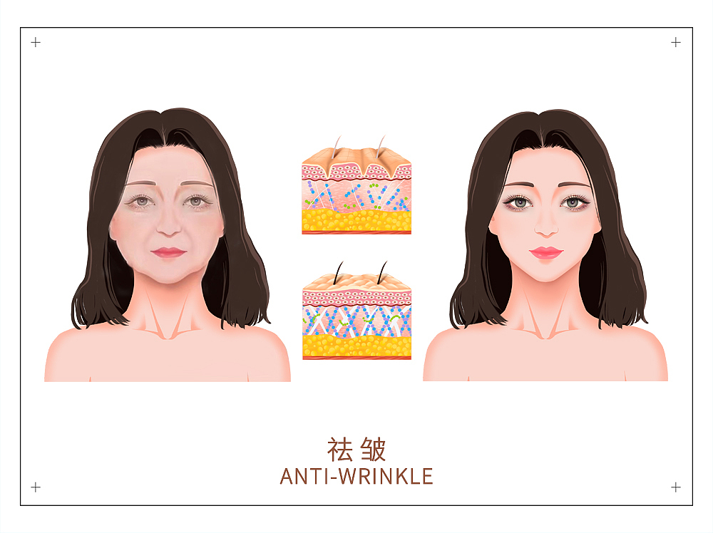 配图 海报（图ZMzY0NDQ4MjYw） - 海报 - 站酷设计师你妖姐原创素材 - 站酷ZCOOL