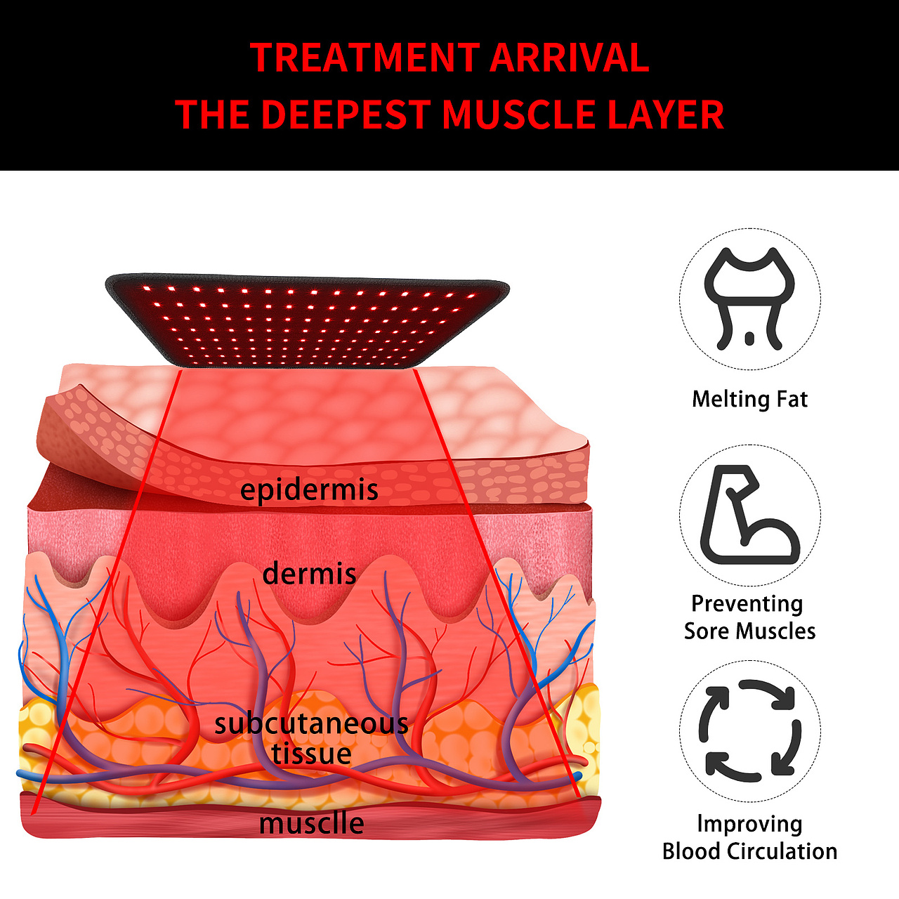 亚马逊案例分享-红色治疗仪