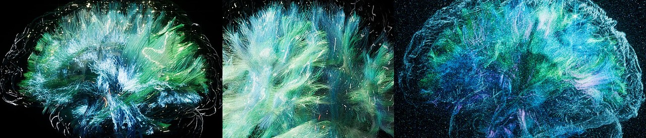 脑新生 动态设计（图ZMzE1MTE0MDAw） - 人物/生物 - 站酷设计师omoolab原创素材 - 站酷ZCOOL