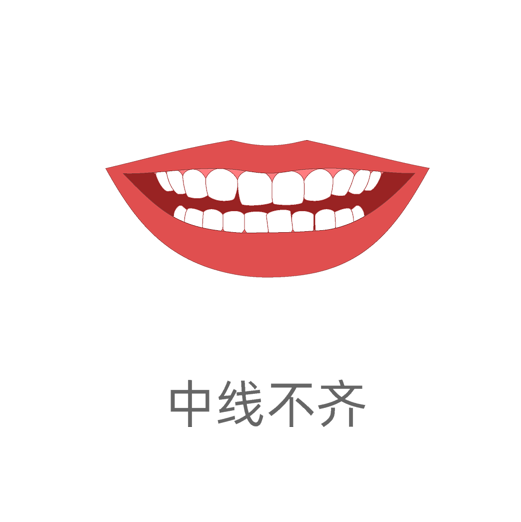 牙齿歪斜类型（图ZMzA4ODkwNTY0） - 商业插画 - 站酷设计师蜀文途话原创素材 - 站酷ZCOOL