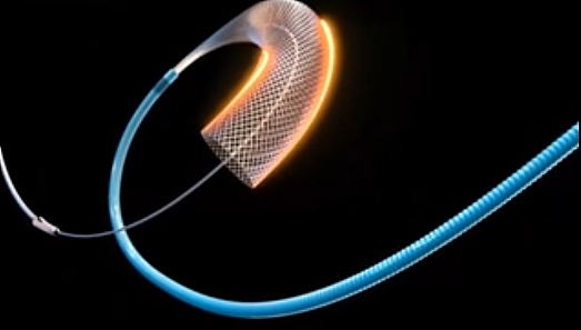 医疗导管（图ZMzY1MTcwMzA0） - 产品 - 站酷设计师徐小贱的日常原创素材 - 站酷ZCOOL