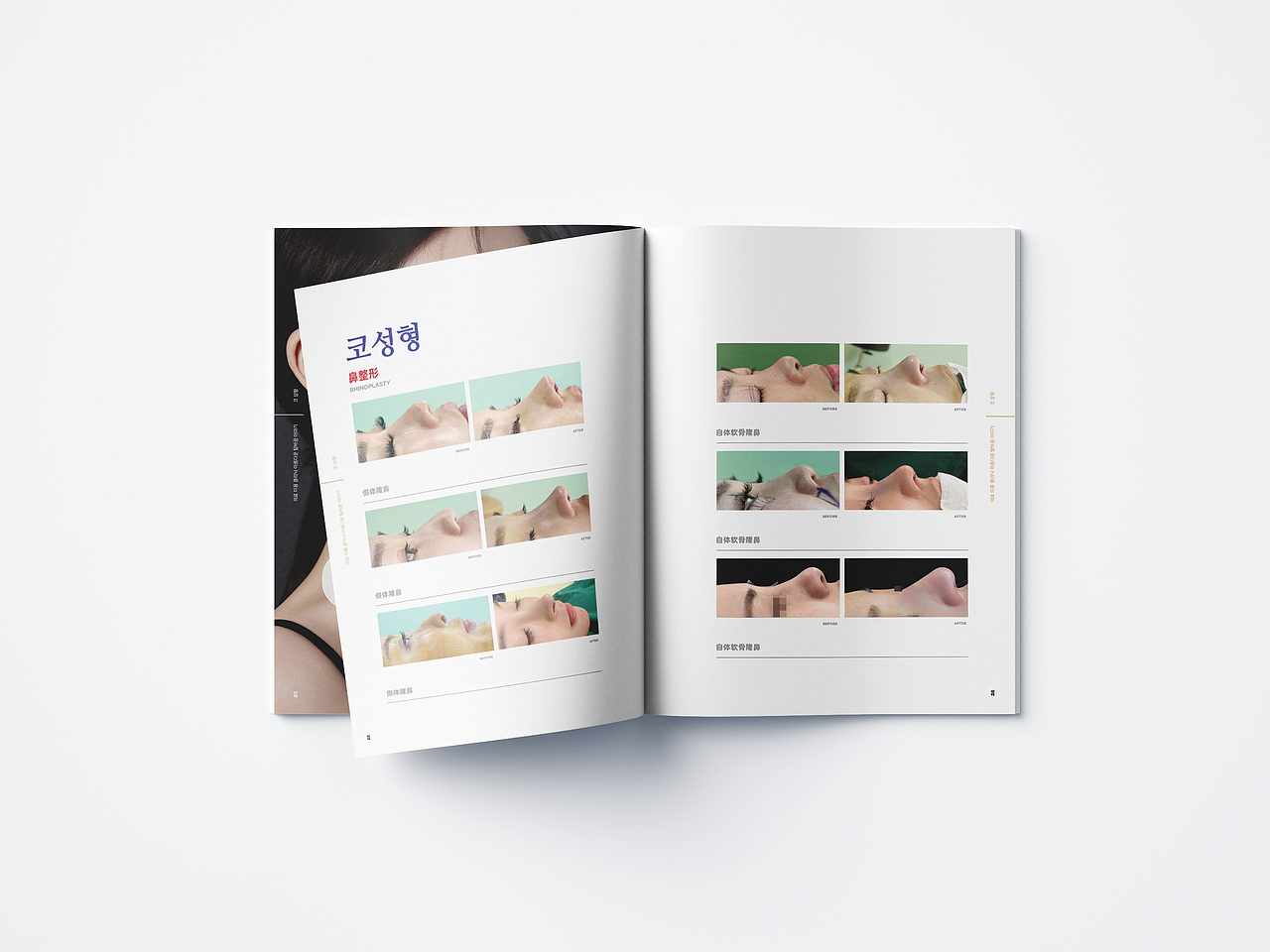 医美画册（图ZMzEzNjgxODM2） - 书籍/画册 - 站酷设计师jack__原创素材 - 站酷ZCOOL