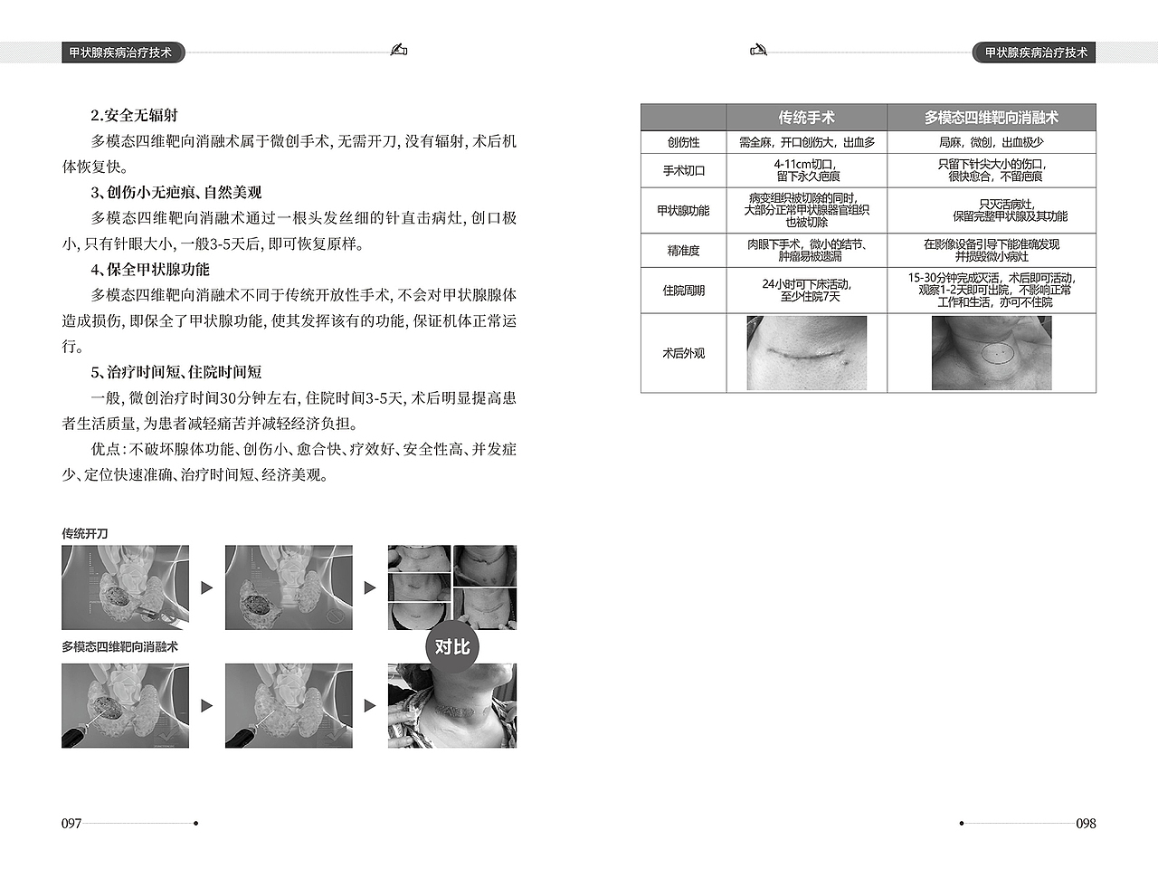 甲状腺疾病健康手册（图ZMzI5NTUxNzUy） - 书籍/画册 - 站酷设计师底特律原创素材 - 站酷ZCOOL