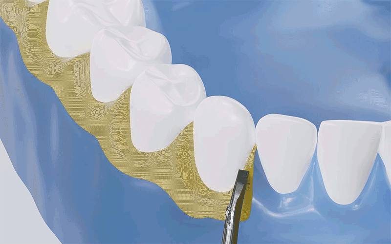 产品动画-电动牙刷（图ZMzQzODI2MDgw） - 其他三维 - 站酷设计师Tongk原创素材 - 站酷ZCOOL