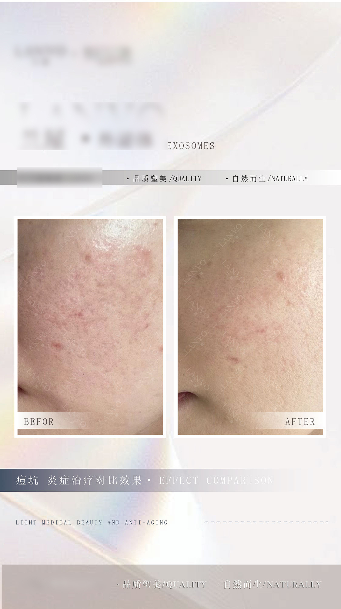 医美行业 案例 对比图