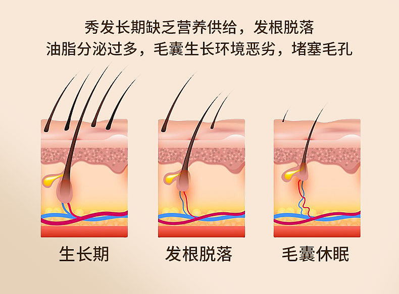 防脱育发洗发水详情