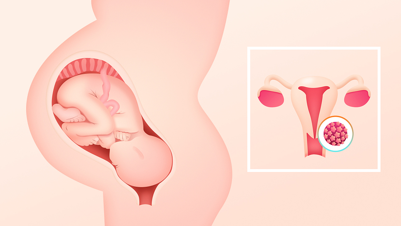 用设计表达真相-医学插画设计