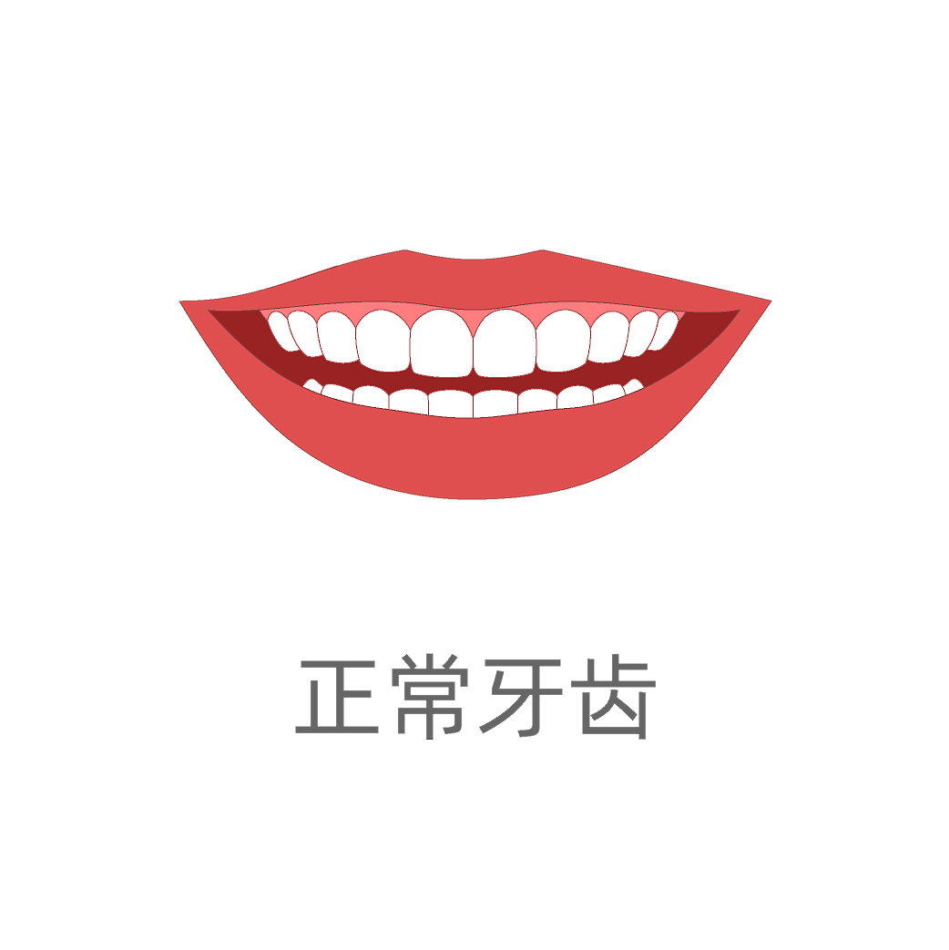 牙齿歪斜类型（图ZMzA4ODkwNTMy） - 商业插画 - 站酷设计师蜀文途话原创素材 - 站酷ZCOOL