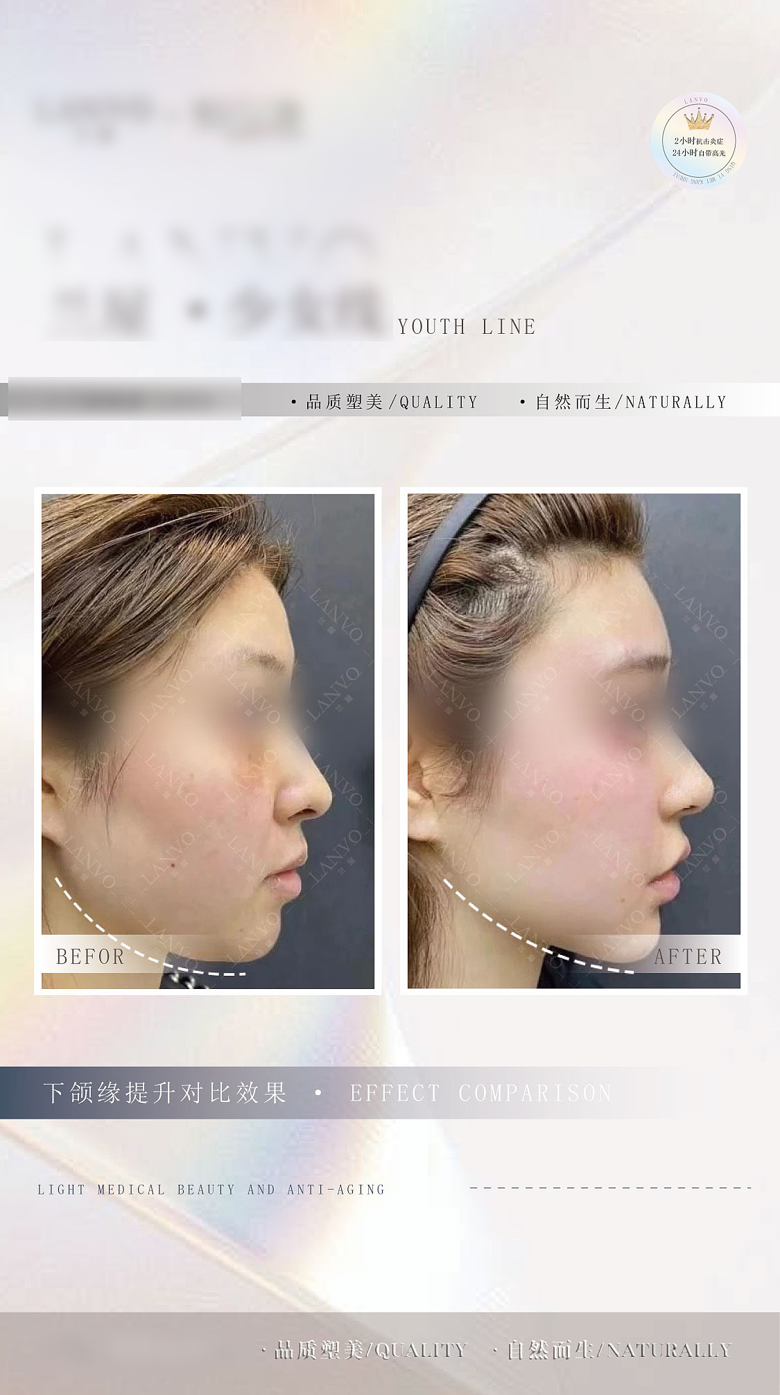 医美行业 案例 对比图