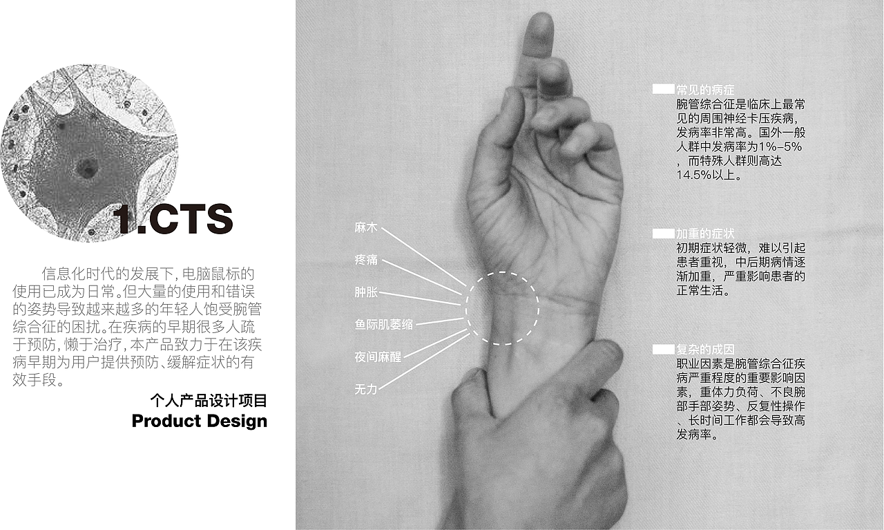 CTS-腕管综合征桌面熏蒸治疗仪（图ZMjk5NTIzNDQw） - 人机交互 - 站酷设计师LXluthor原创素材 - 站酷ZCOOL