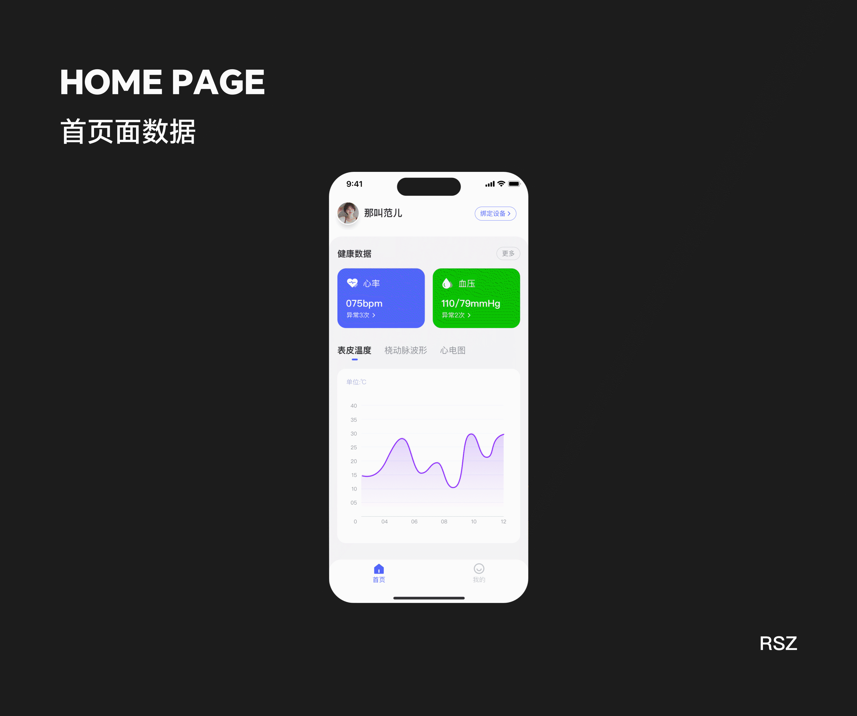 智能设备&智能手表