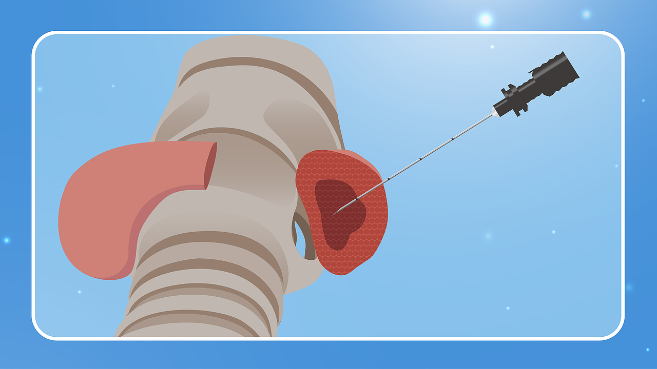 活检针视频分镜