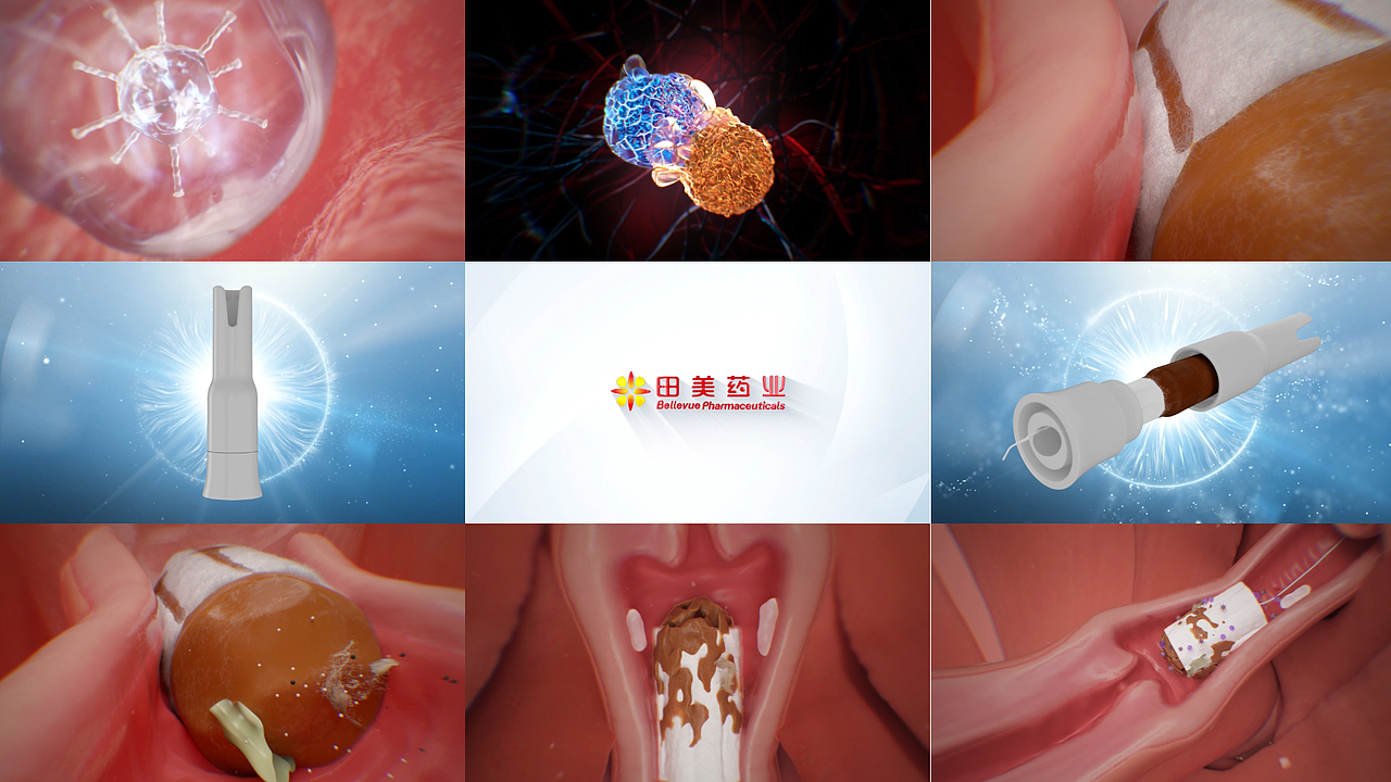 医学医疗原理动画展示-医疗动画制作公司