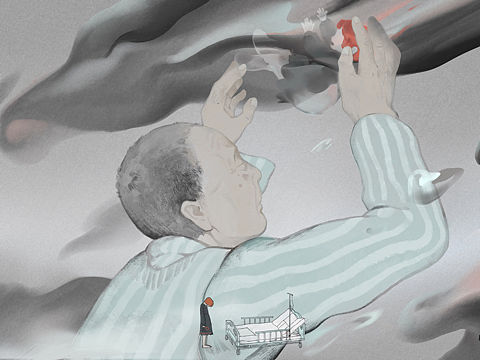 阿尔茨海默氏症