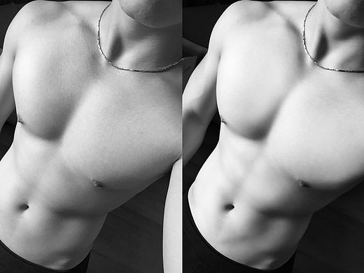 ps练习:祛痘磨皮美容