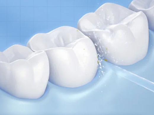 洗牙詳情頁（個(gè)人主頁-ZNTk3MzI3MzY=） - 電商 - 站酷設(shè)計(jì)師塔米615原創(chuàng)素材 - 站酷ZCOOL